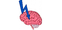 Picture of a brain with an arrow representing the stroke section.