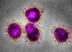 Picture of Virus representing the 2019 Coronavirus